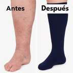 Calcetines de compresión